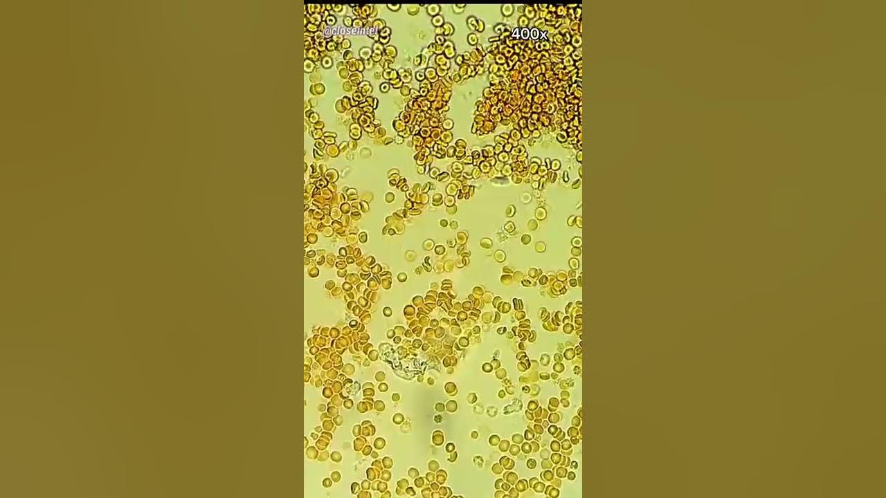 Drop of Blood Under Microscope YouTube