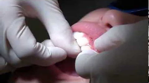 Dr Samson Chan teach you how to floss your teeth