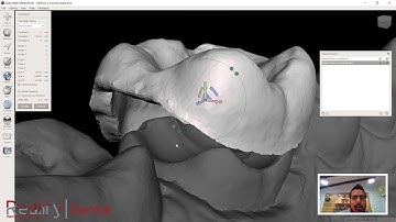 Reality Dental - Corona sobre Muñon Digital en Autodesk Meshmixer