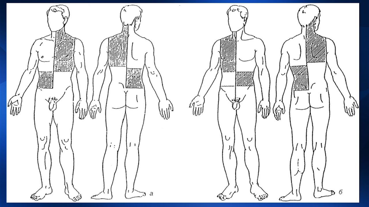 схема проведения массажа. рефлекторно-сегментарный массаж зоны крестца. массаж передней поверхности тела тест с ответами. лимфодренажный массаж схема линий. массаж передней поверхности тела тест с ответами.
