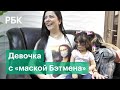 Сбросить «маску Бэтмена». Лечение двухлетней Луны из США обернулось травлей в соцсетях