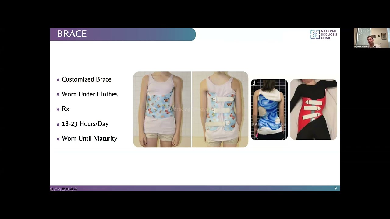 Your Child Can Beat Scoliosis Webinar