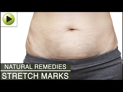 skin-care---stretch-marks---natural-ayurvedic-home-remedies