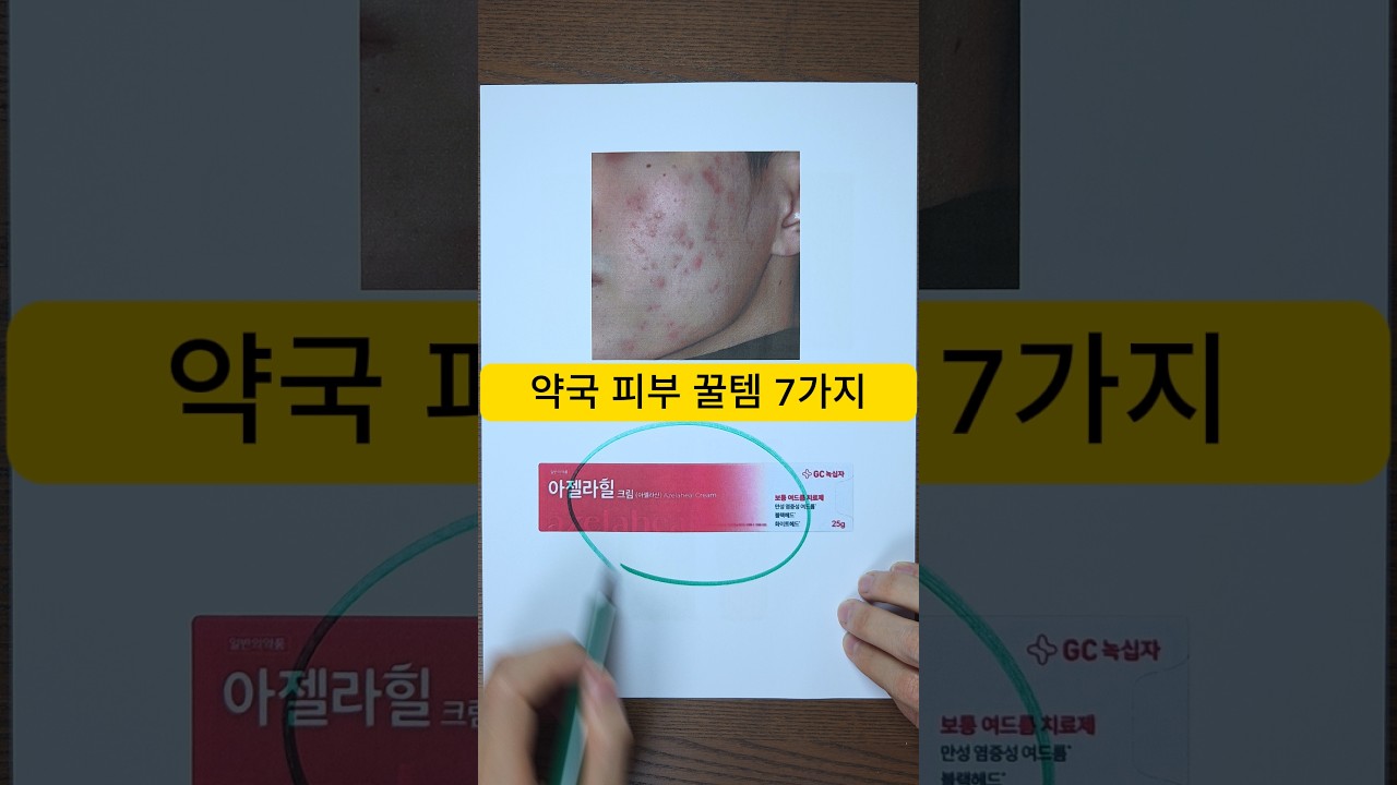 피부 고민별 약국 꿀템 7가지
