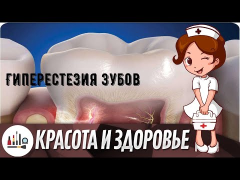 Гиперестезия зубов