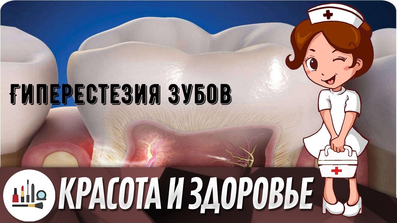 Гиперестезия зубов