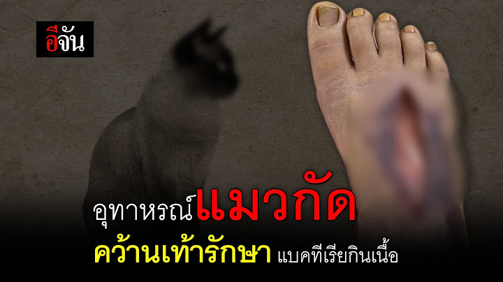 อุทาหรณ์แมวกัด คว้านเท้ารักษา แบคทีเรียกินเนื้อ | อีจัน EJAN