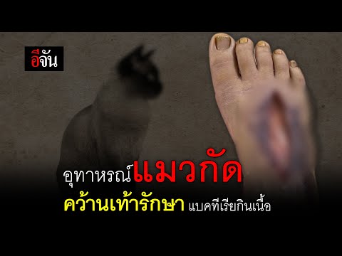 อุทาหรณ์แมวกัด คว้านเท้ารักษา แบคทีเรียกินเนื้อ | อีจัน EJAN