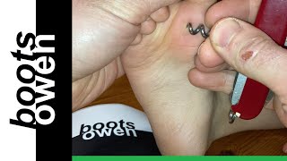 Quick and easy way to remove a huge splinter from a child's foot! Chocolate to the rescue!