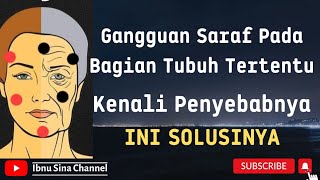 Solusi Sembuh Untuk Penyakit Saraf @ibnusinachannel2983