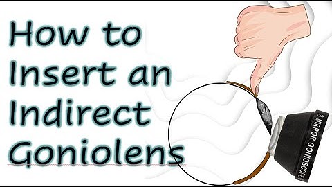 How to Insert an Indirect Goniolens
