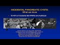 Incidental pancreatic cysts - what we know and what we don't know, Jay Heiken