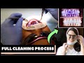 HOW TEETH ARE CLEANED AT THE DENTIST |  Step-by-Step Guided Biofilm Therapy