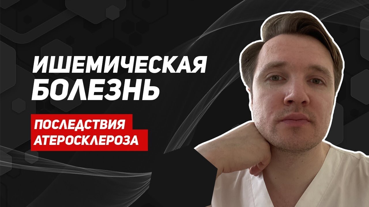 Ишемическая болезнь: причины, профилактика, лечение - YouTube