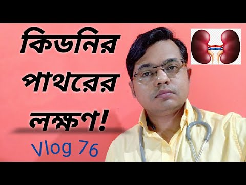 ভিডিও: আর্থো কি একটি উপসর্গ?