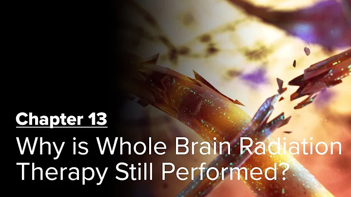 Why is Whole Brain Radiation Therapy Still Performed? Chapter 13 — Brain Metastases: A Documentary