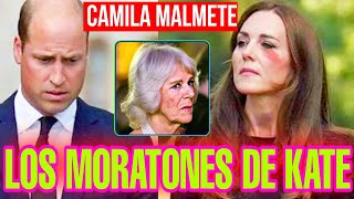 💥PRENSA ALEMANA FILTRA TRISTES NOTICIAS de Kate Middleton y William tras BRONCA FUERTE con Camila