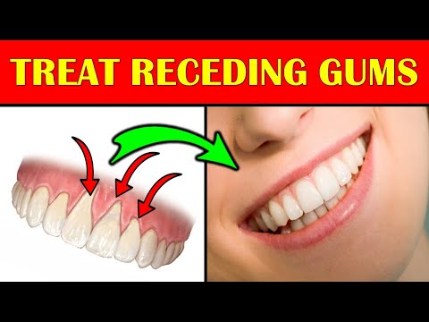 7 EFFECTIVE Ways to Regrow Gums Naturally