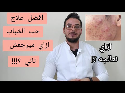 افضل علاج حب الشباب؟ ازاي نعالجه وميرجعش تاني؟؟