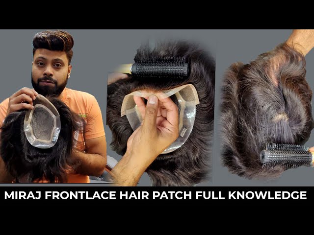 Hair Patch For Men | Best Hair Patch Center In India |Non surgical Hair  Bonding in Lucknow| - YouTube