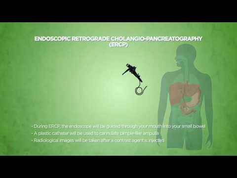 Endoscopic Retrograde Cholangiopancreatography (ERCP)