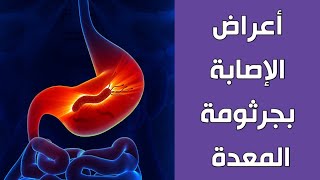 أعراض الإصابة بجرثومة المعدة