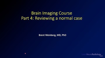 Brain imaging course – 4 – Reviewing a normal case