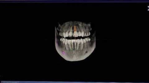 Cone Beam 3D Imaging