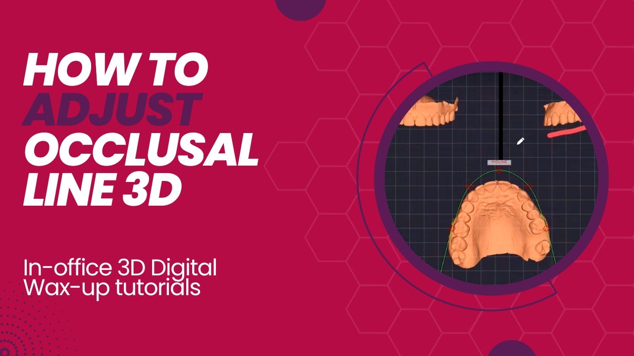 Part 02 HOW TO ADJUST OCCLUSAL LINE 3D YouTube