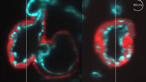 High-resolution reconstruction of the beating zebrafish heart 9