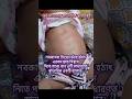 নবজাতকের স্বাভাবিক শ্বাসকষ্ট। #baby