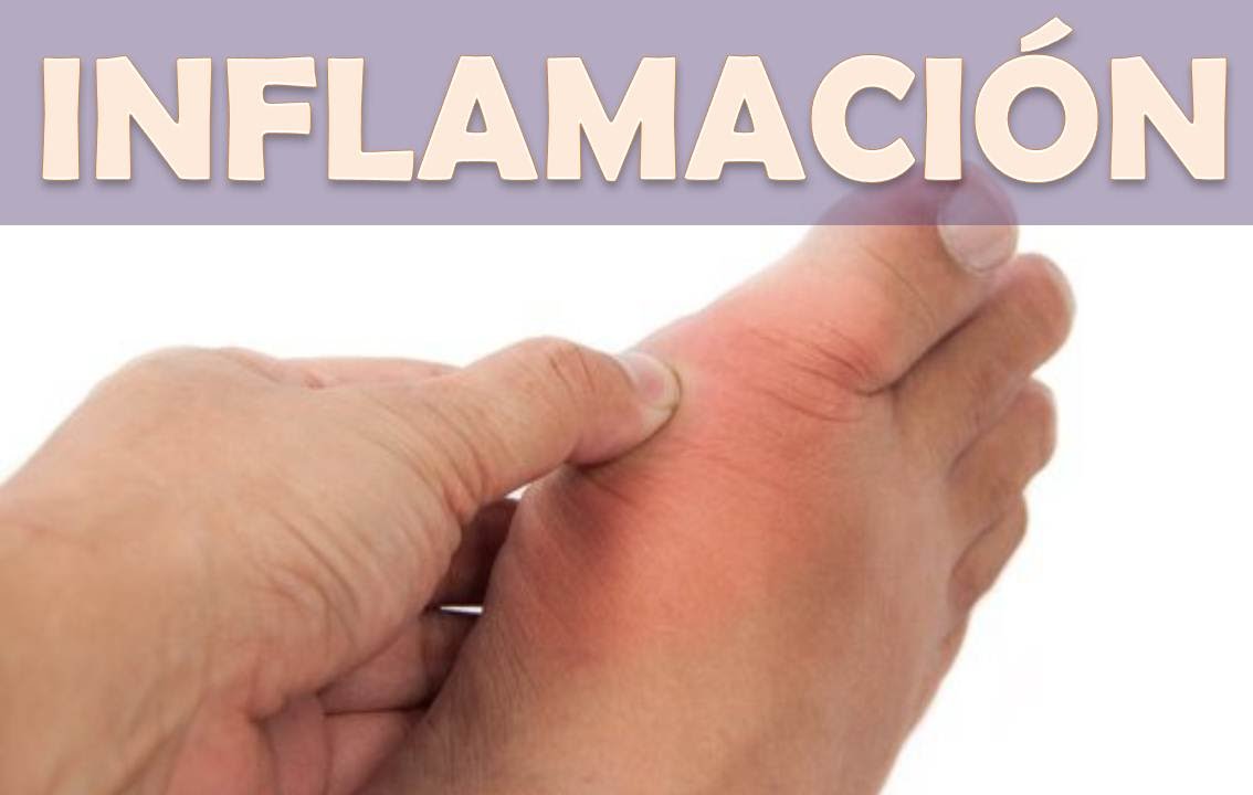 Los ungüentos para el levantamiento del dolor a varikoze