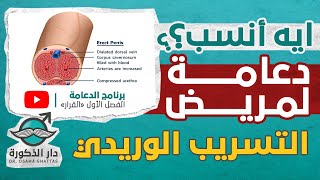 ايه انسب دعامة لمريض التسريب الوريدي؟ برنامج القرار الحلقة 30