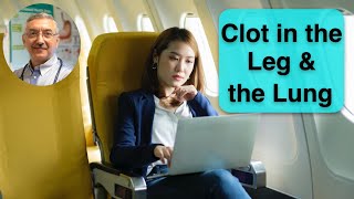 Blood clot can happen after a long travel