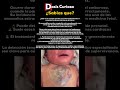 La enfermedad más impactante que nunca viste #medicofacts
