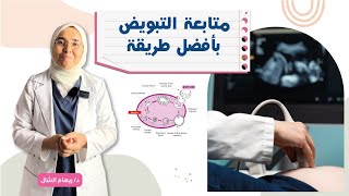 متابعة التبويض بالسونار حالة من العيادة المفروض نشوف ايه فى الرحم و المبيض ؟#shorts د. ريهام الشال