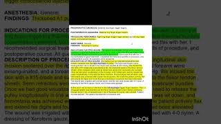 Learn trigger finger release & injec #Trigger finger #cpt #medical coding #pharma #nursing #physio 