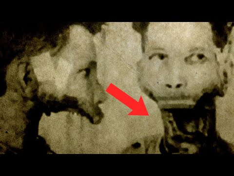 amelia maggia jaw and radium poisoning amelia maggia jaw and radium poisoning