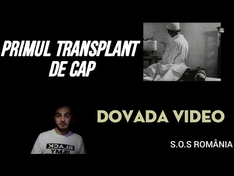 Un corp mort a fost readus la viață  Dovada video primul transplant de cap reusit in URSS DOCUMENTAR