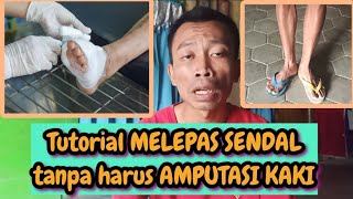 tutorial MELEPAS SENDAL tanpa AMPUTASI KAKI | How to take off sandals