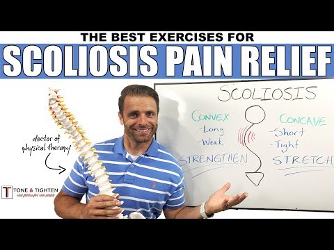 Video: Scoliosepijn: Rug, Verlichting En Symptomen