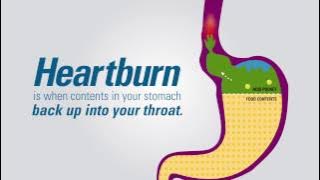 What is Heartburn?