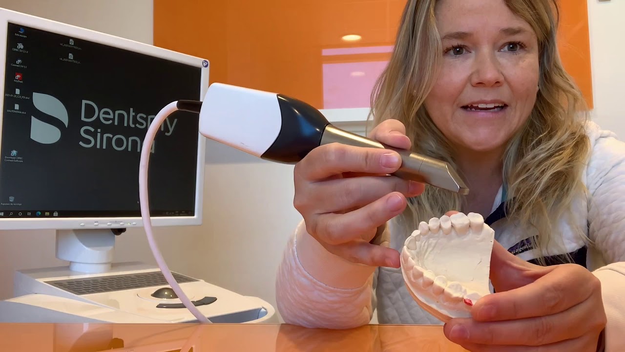 Escaneo intraoral con CEREC