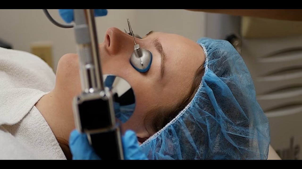 Transform Your Skin with ProFractional Laser Resurfacing at Turkle & Associates