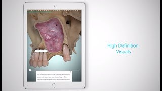 Touch Surgery - Anatomy for Maxillary Sinus Floor Augmentation