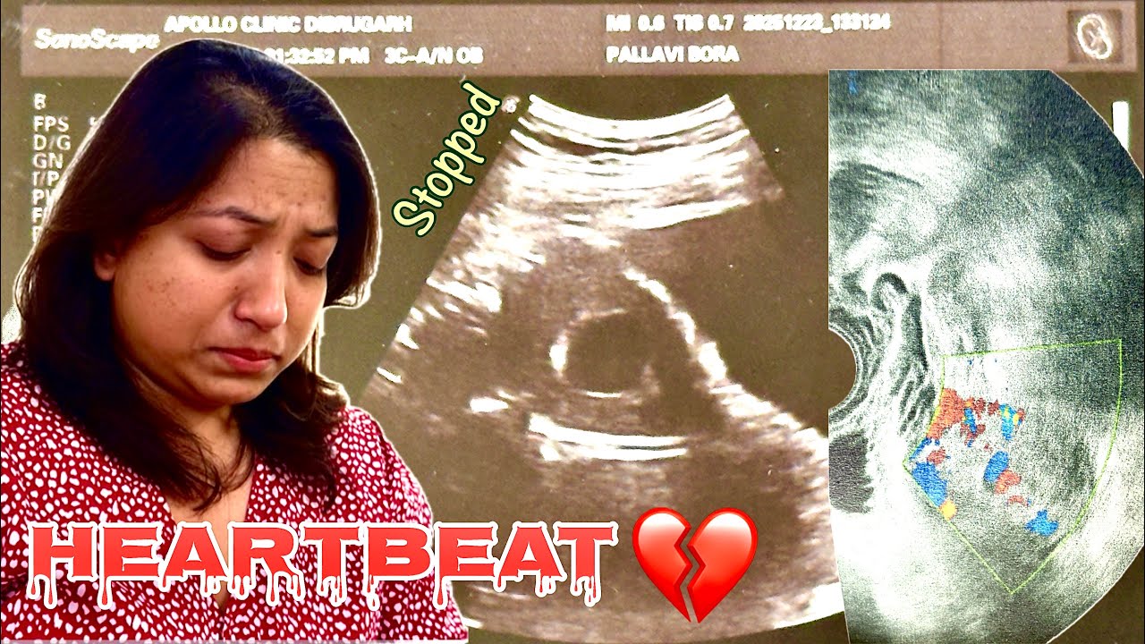 Missed Miscarriage | Surgery & Strength | Physical & Emotional Pain | Healing Together | Our Loss 💔👼