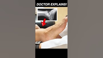 Reduction of an Ankle Dislocation | Doctor Explains! #anatomy #medicalstudent #emergency #medicine