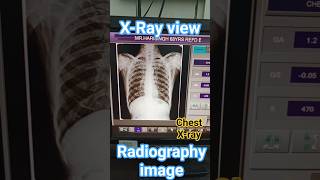 Chest x-ray ||Radiography image #xray #shortvideo #bone
