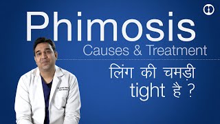Phimosis causes and treatment | लिंग की चमड़ी टाइट होने के कारण और इलाज | टाइट फ्रेनुलम में फ़र्क