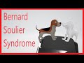 Bernard soulier syndrome